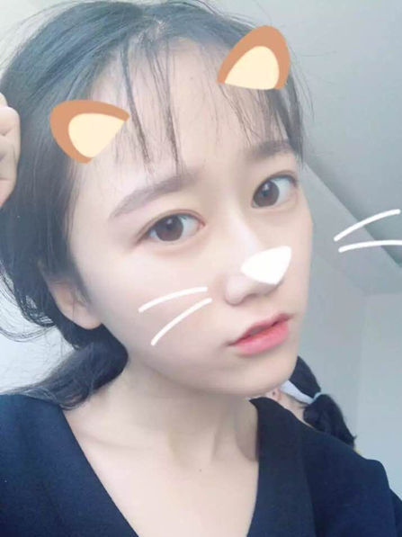 张凯婷